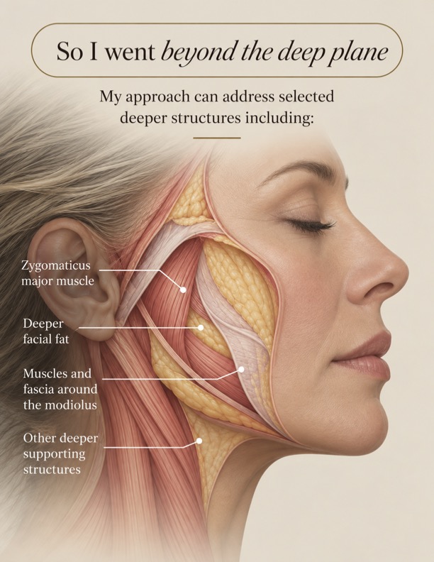 Facial anatomy showing the zygomaticus major muscle, deeper facial fat, fascia, and supporting structures beneath the deep plane