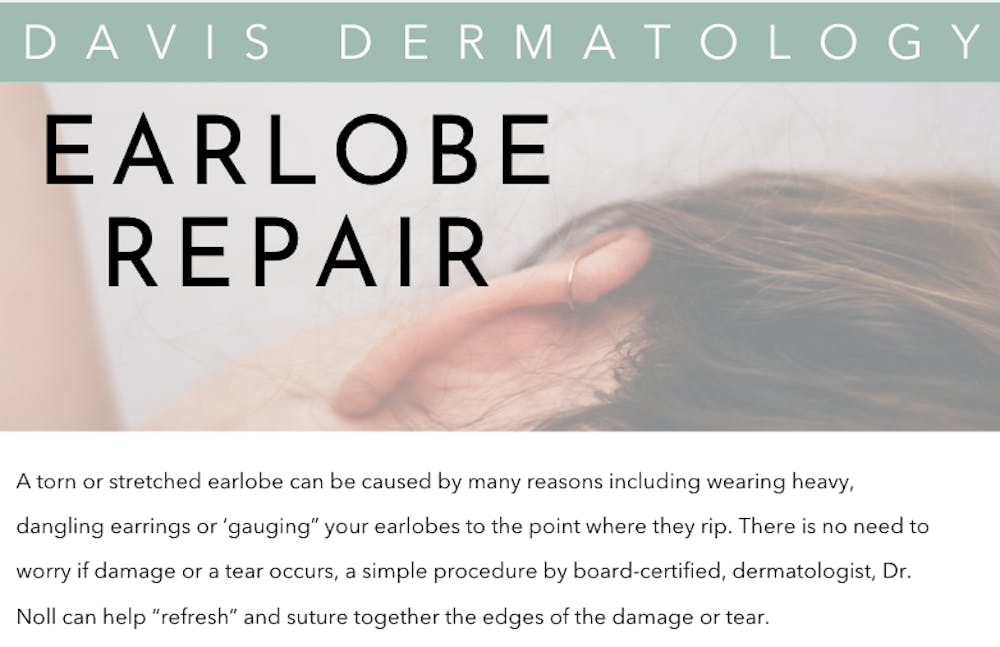 earlobe repair infographic