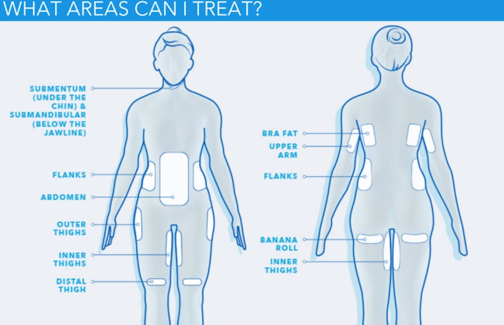coolsculpting infographic