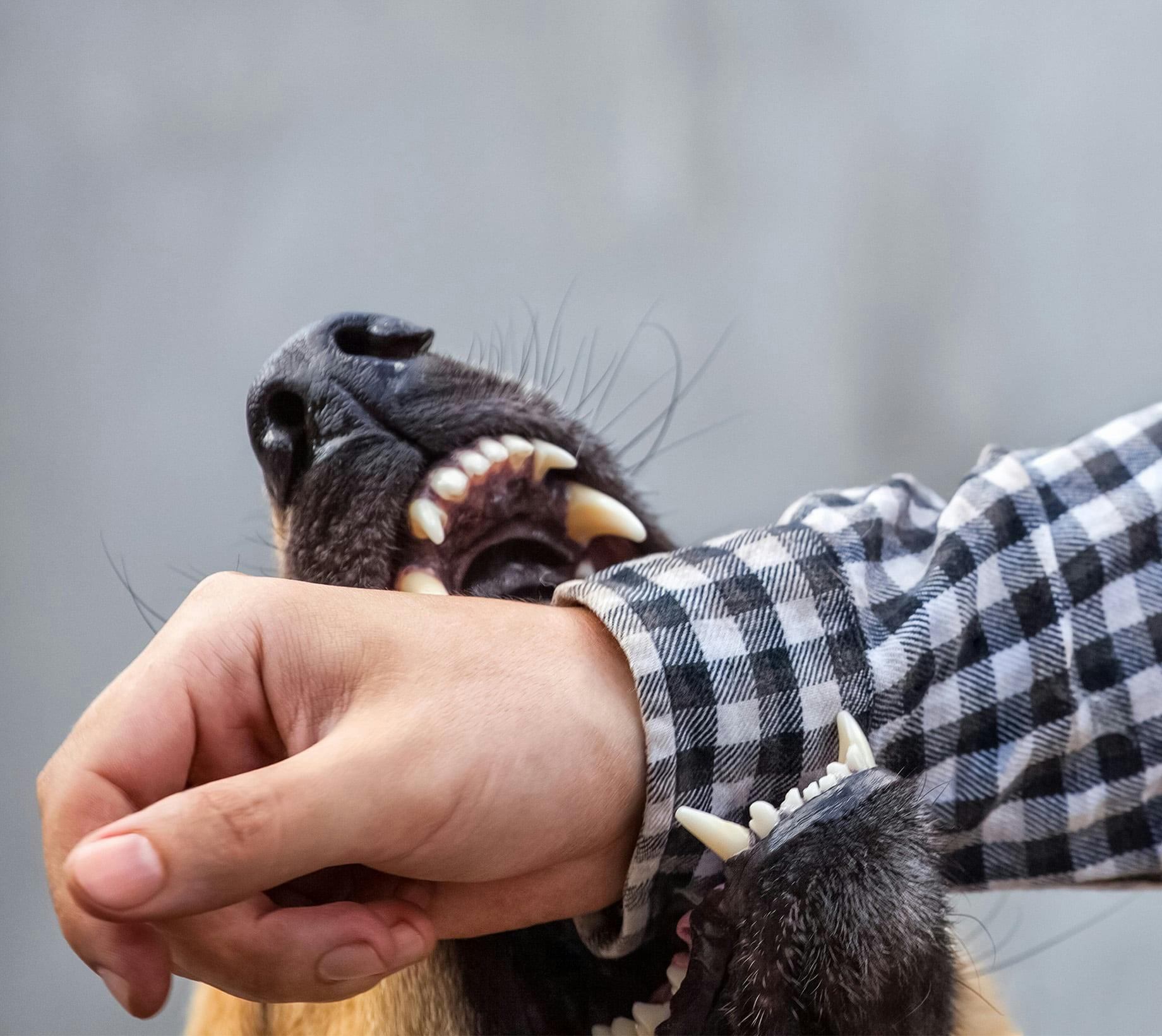 Dog biting man's arm
