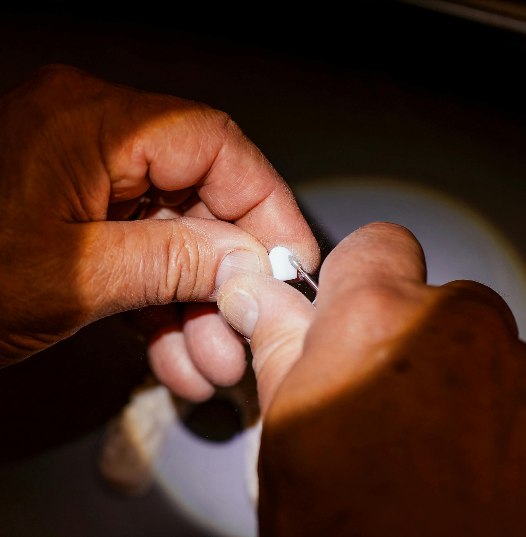 spotlight on a fake tooth getting smoothed