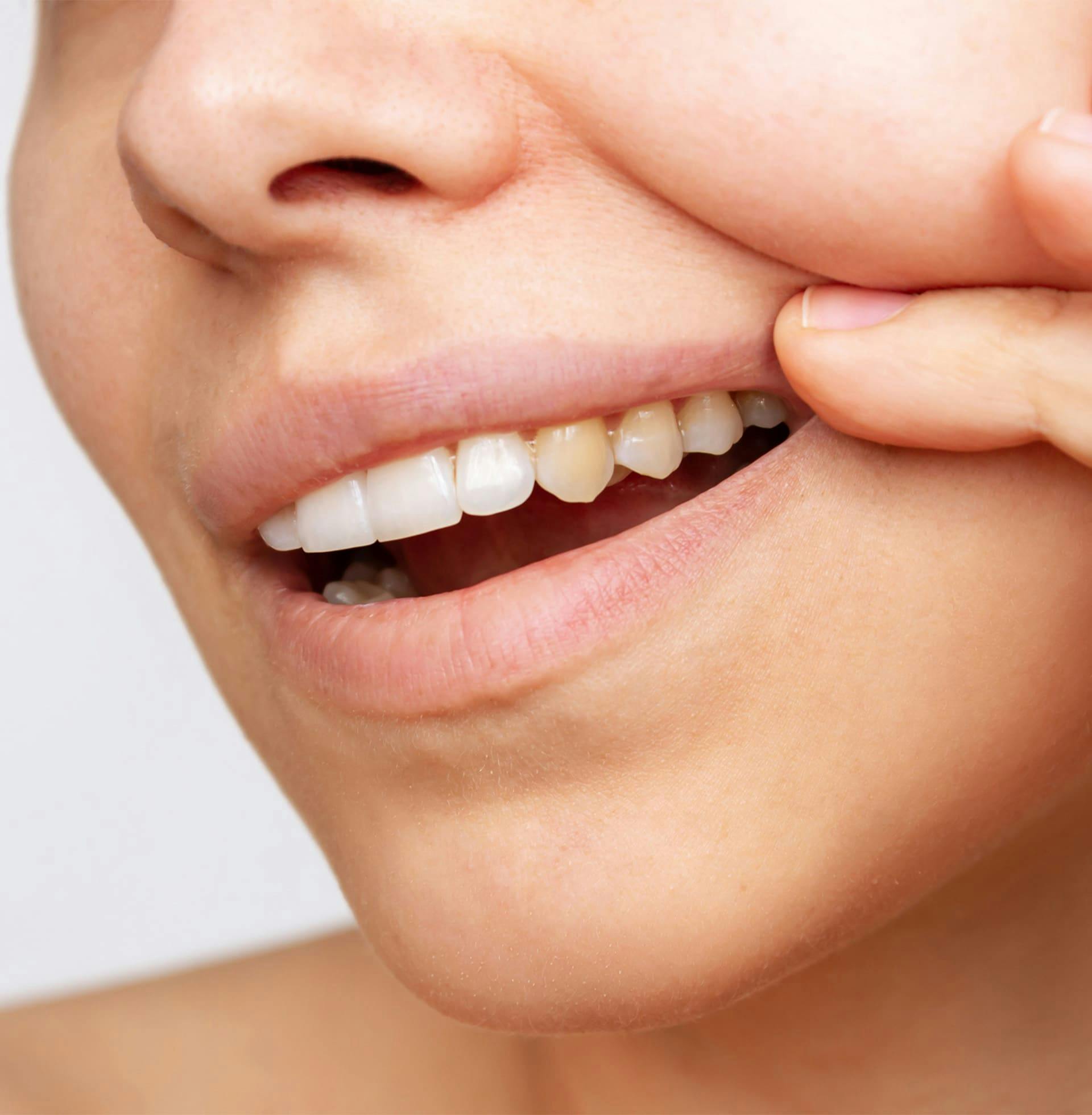 close up on woman's mouth showing her stained teeth