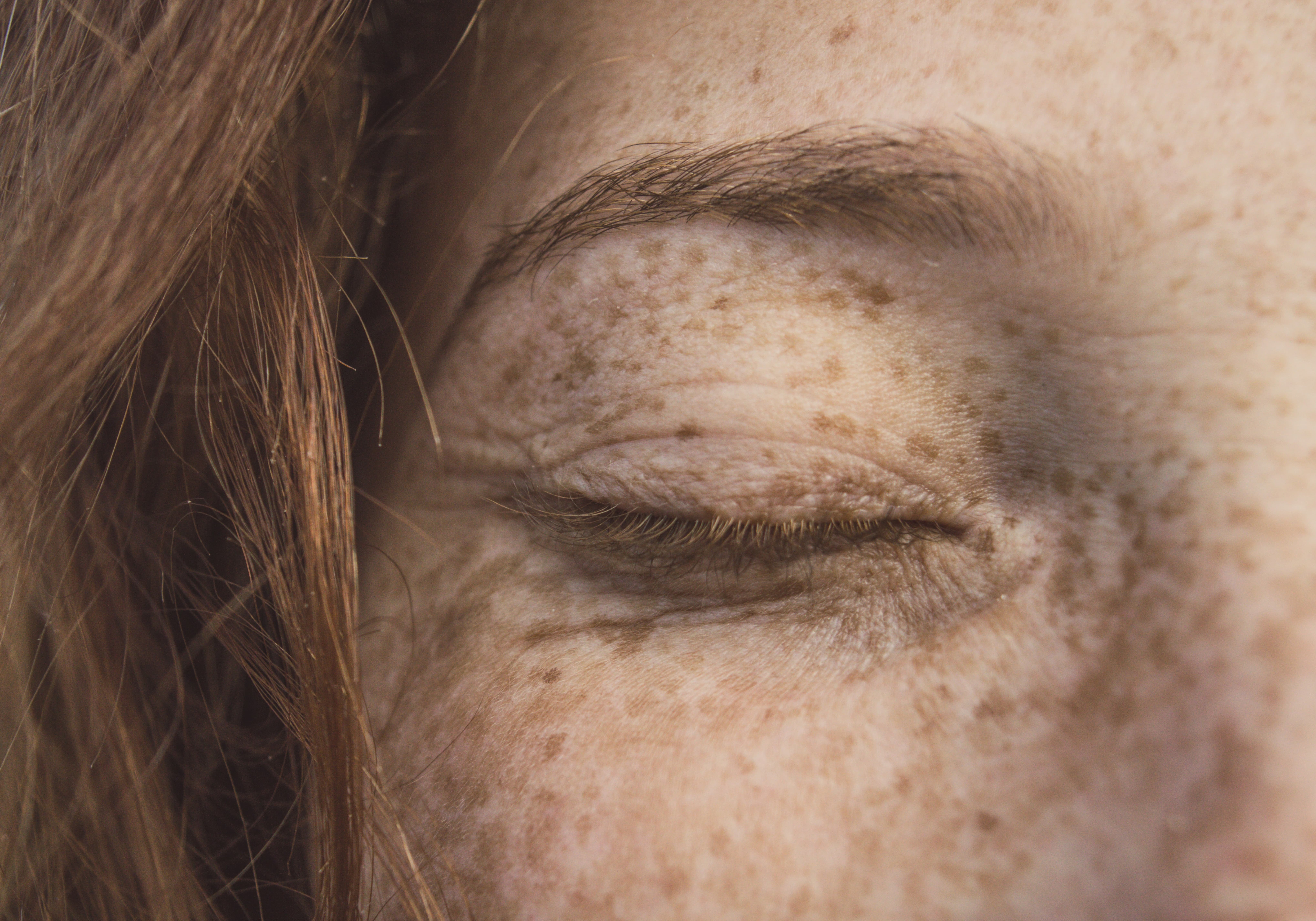Macro shot of a person's face with freckles, showing a closed eye and soft natural lighting highlighting skin texture