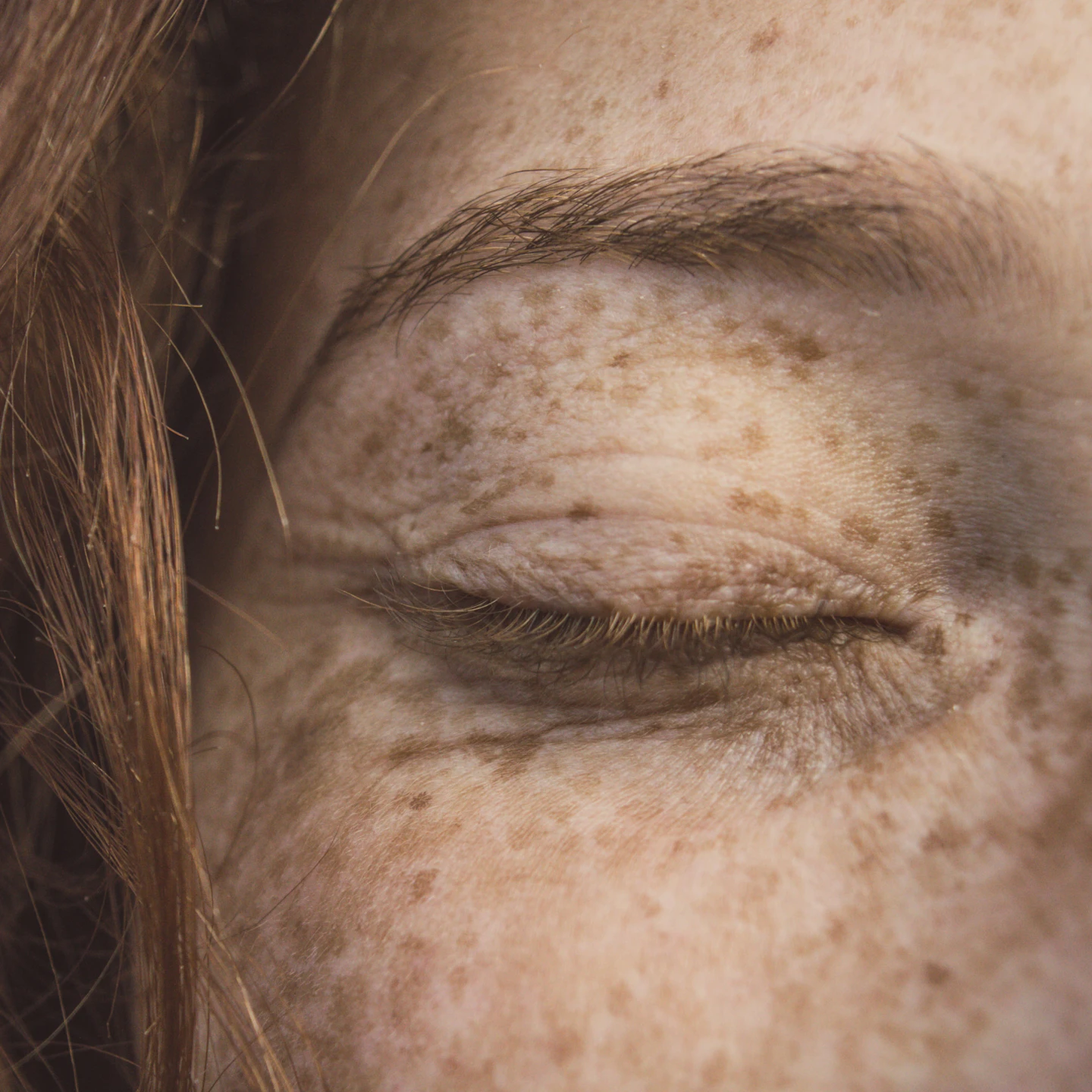 Macro shot of a person's face with freckles, showing a closed eye and soft natural lighting highlighting skin texture