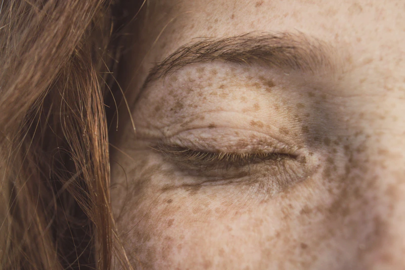 Macro shot of a person's face with freckles, showing a closed eye and soft natural lighting highlighting skin texture