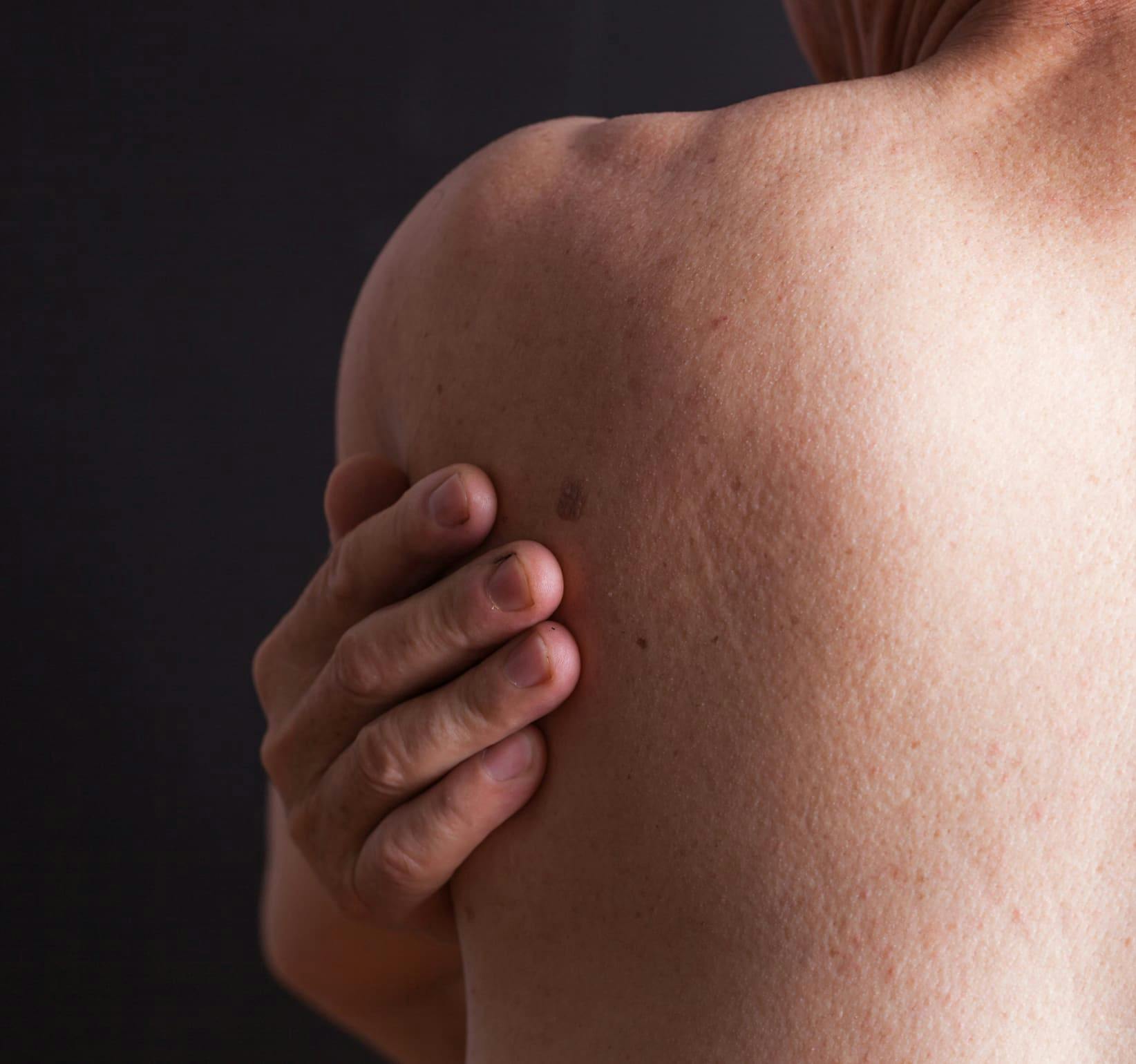 person's back as they touch their shoulder blade