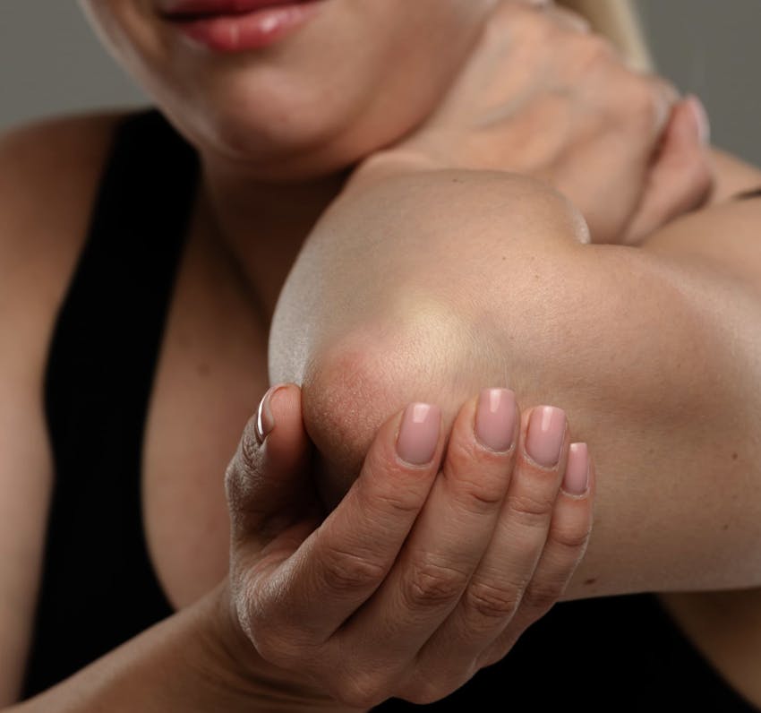 close up on woman touching her red elbow