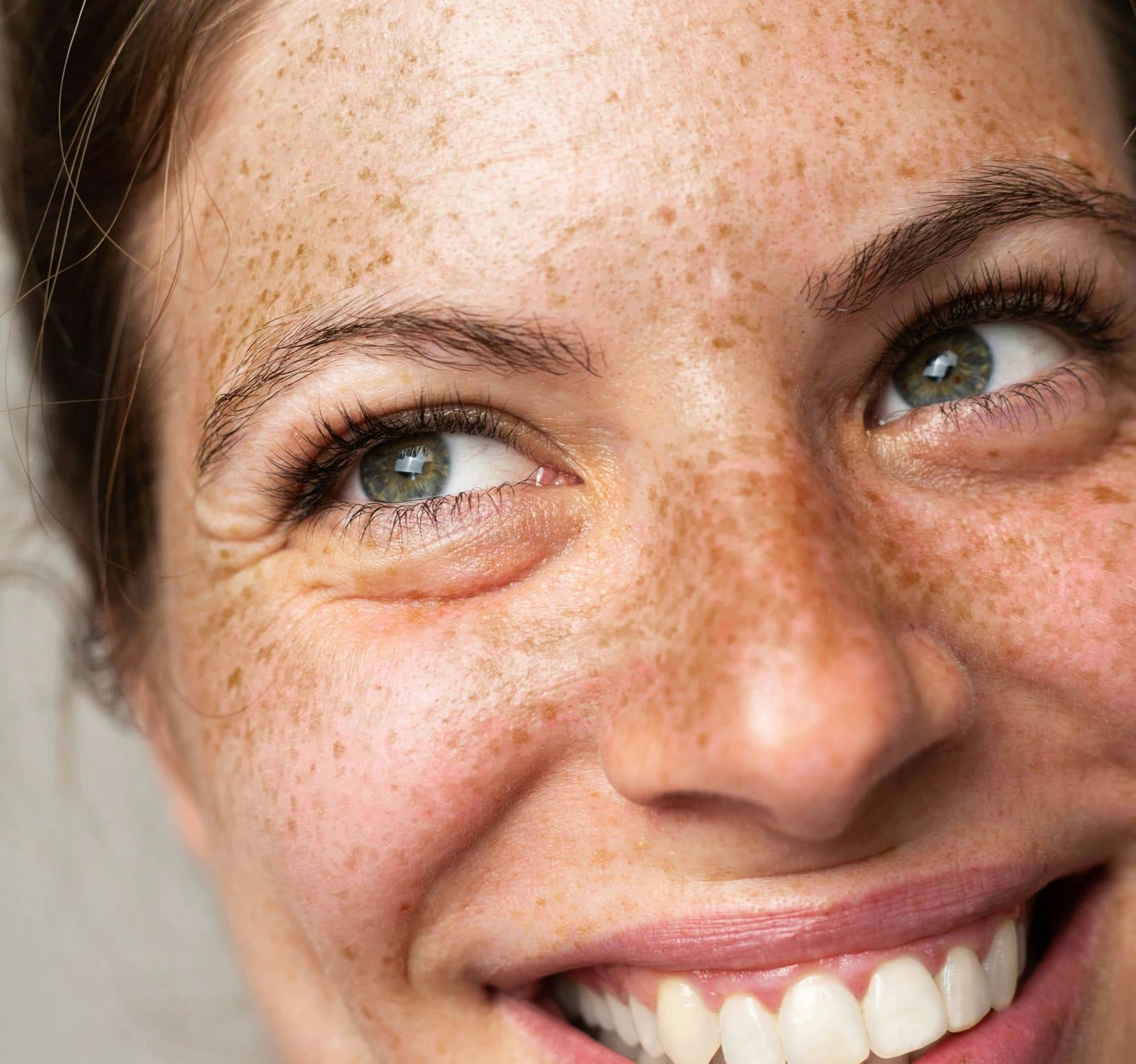 close up on woman smiling with freckles and green eyes