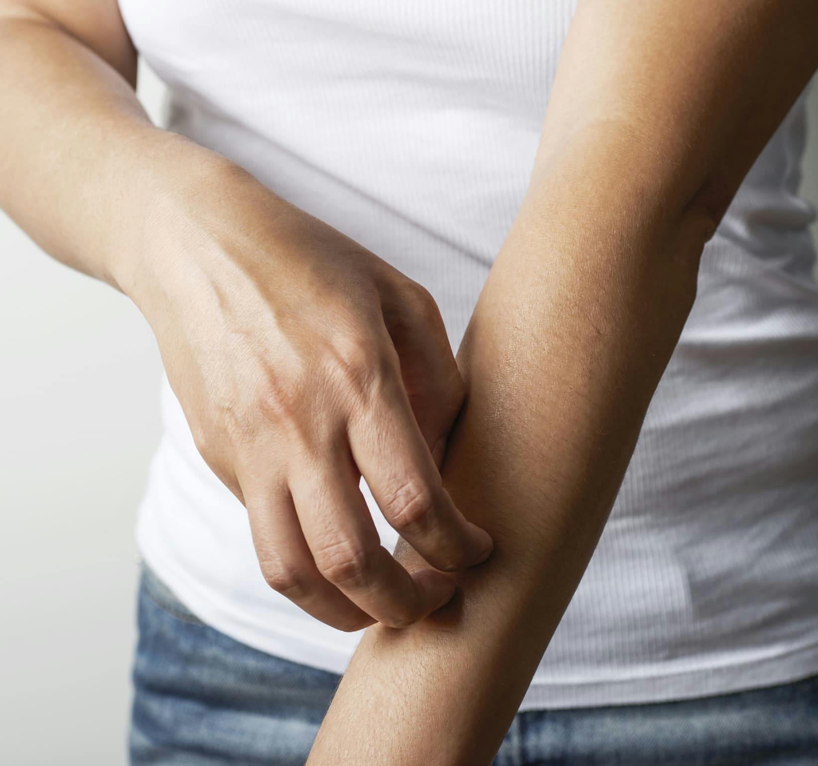 close up on person scratching their forearm