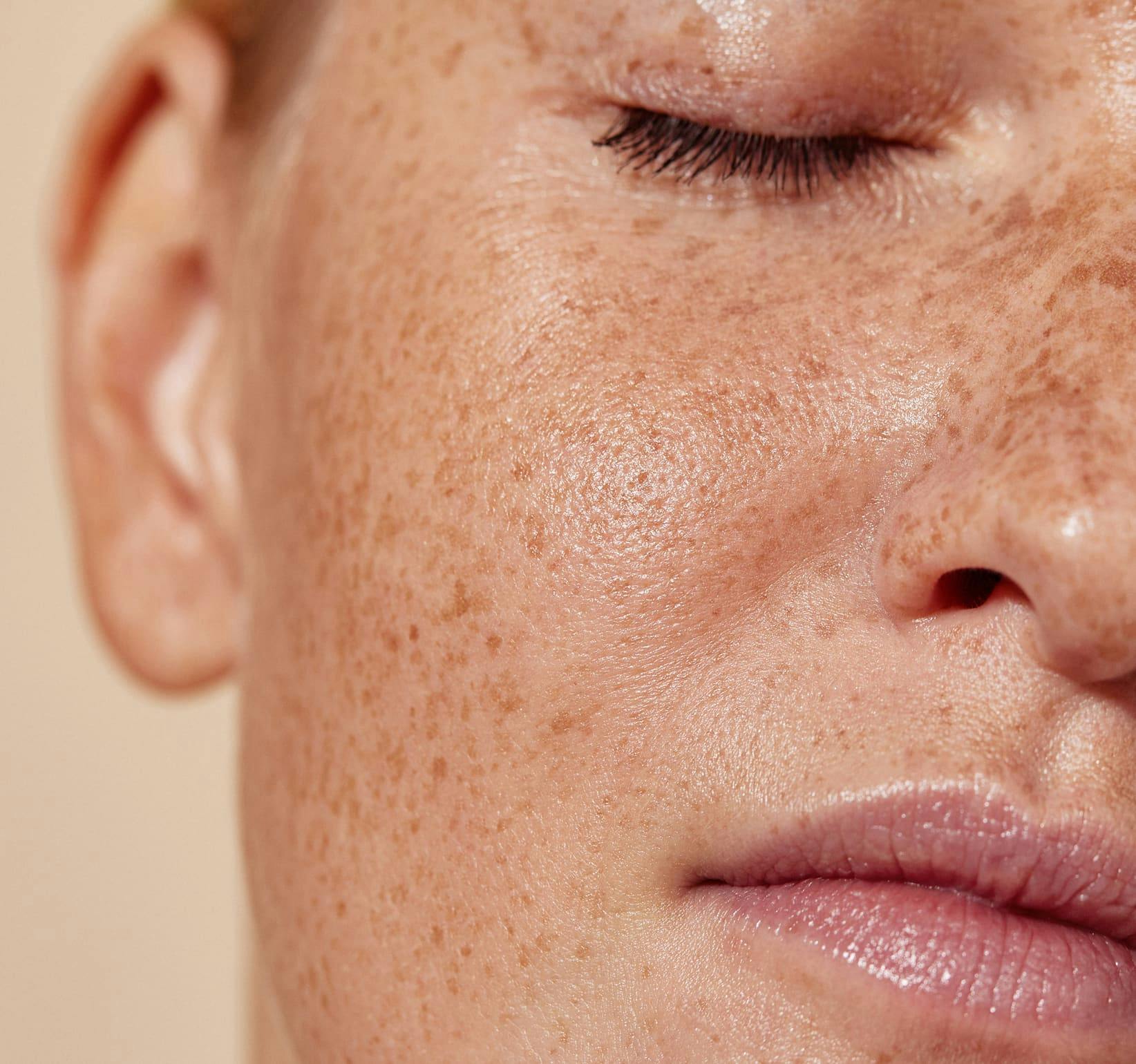 close up on woman's freckled face with her eyes closed