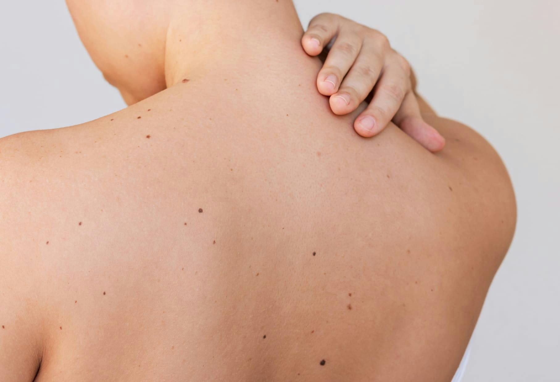 backside of person as they touch the top of their spine with their hand