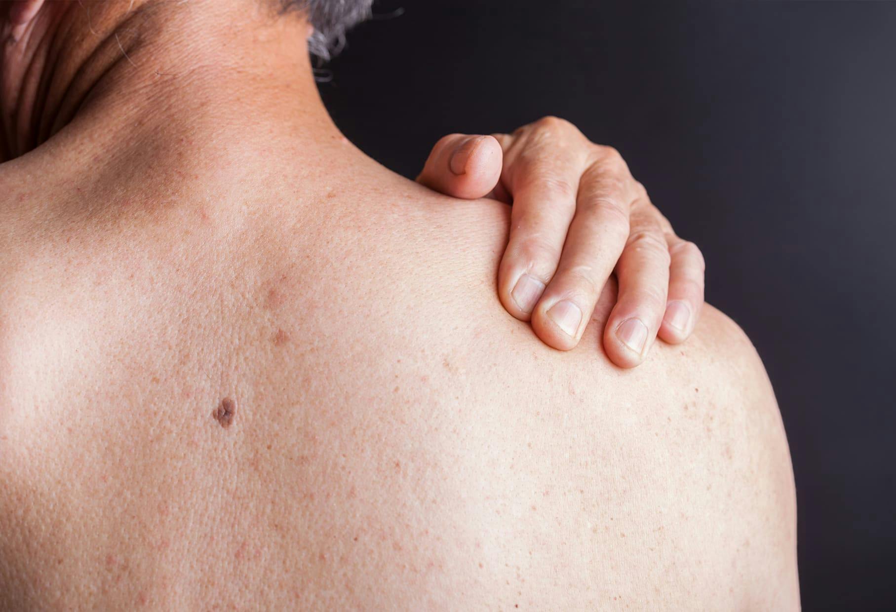 backside of person with their hand on their shoulder