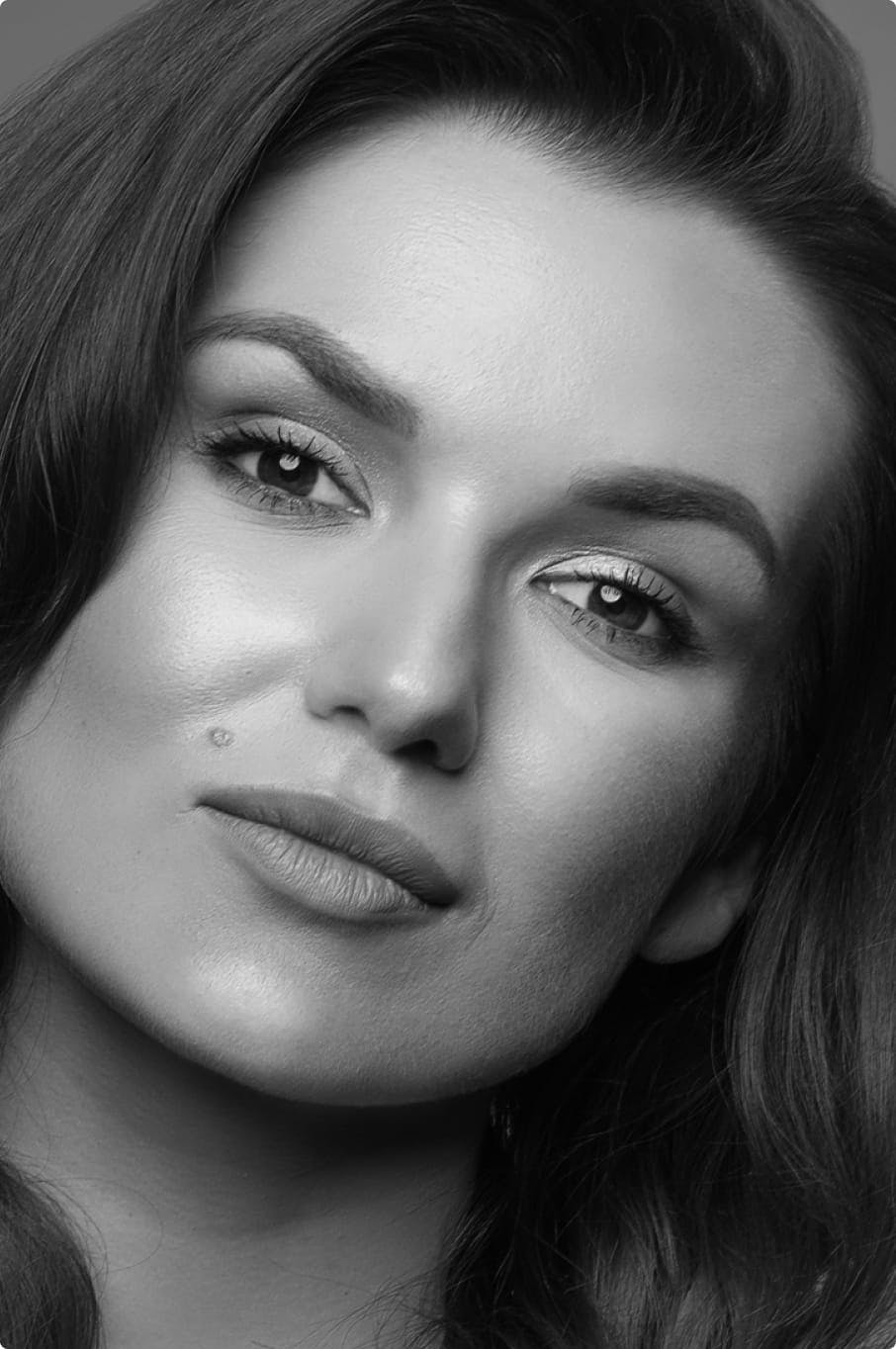 Woman smiling showing natural lip results