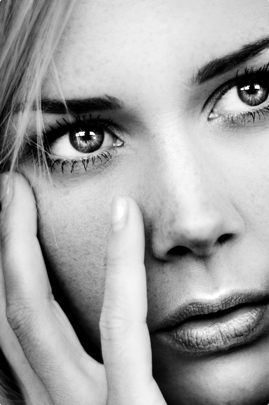 Side profile showing nose treatment result