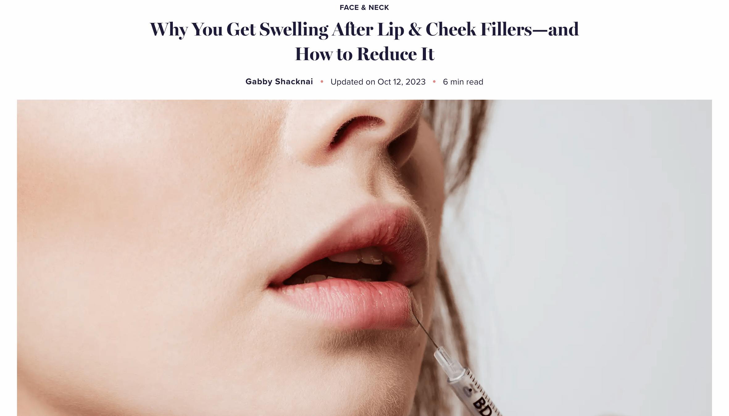 RealSelf features Dr. Stephen Weber in “Why You Get Swelling After Fillers—and How to Reduce It.”