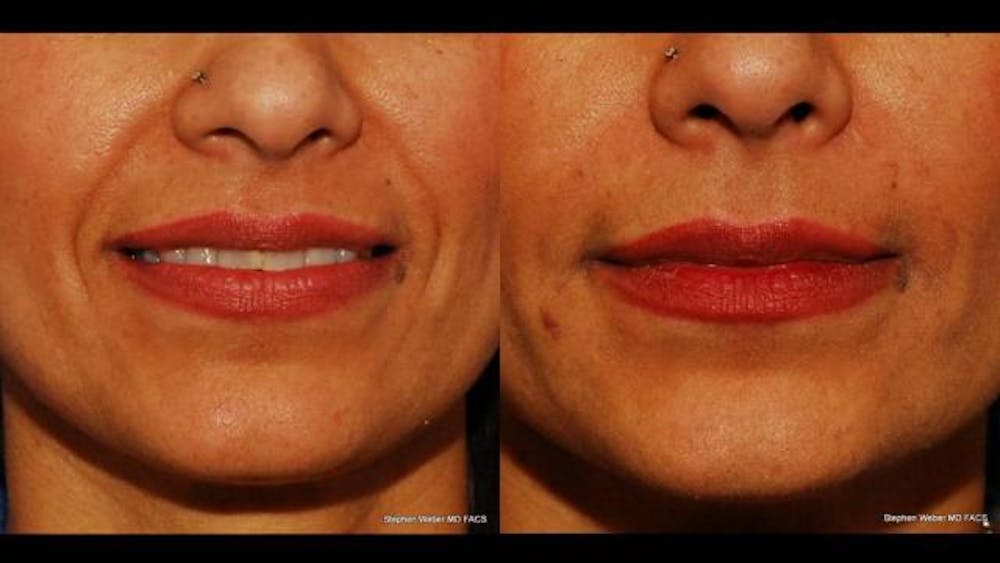 Injectable Days! Back by Popular Demand