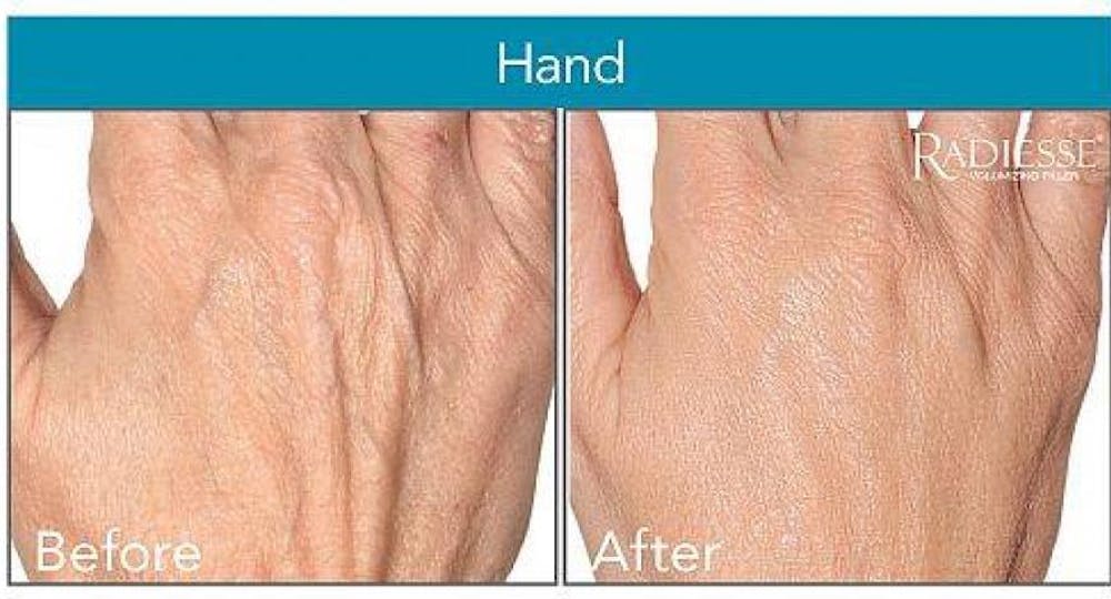 Aging Hands in Denver, CO Aging Hands in Denver, CO