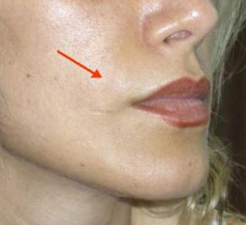 Non-Surgical Before & After Gallery - Patient 180841 - Image 2