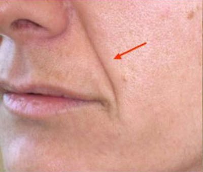Non-Surgical Before & After Gallery - Patient 284158 - Image 1