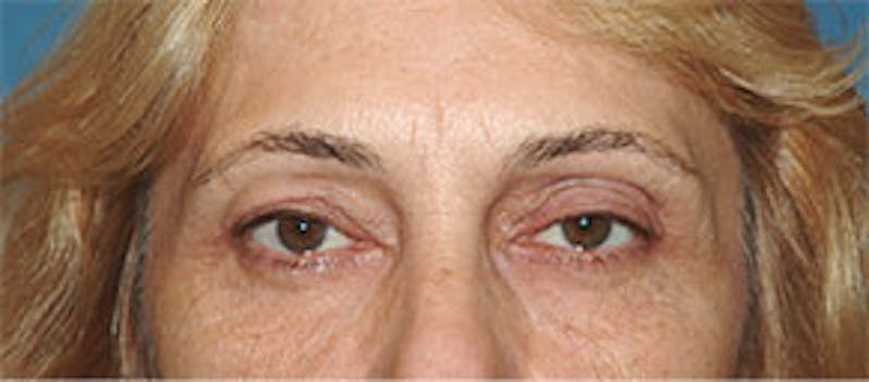 Surgical Before & After Gallery - Patient 468775 - Image 1