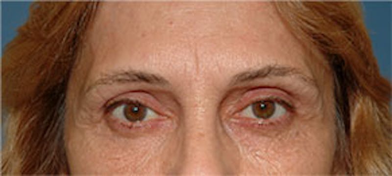 Surgical Before & After Gallery - Patient 468775 - Image 2