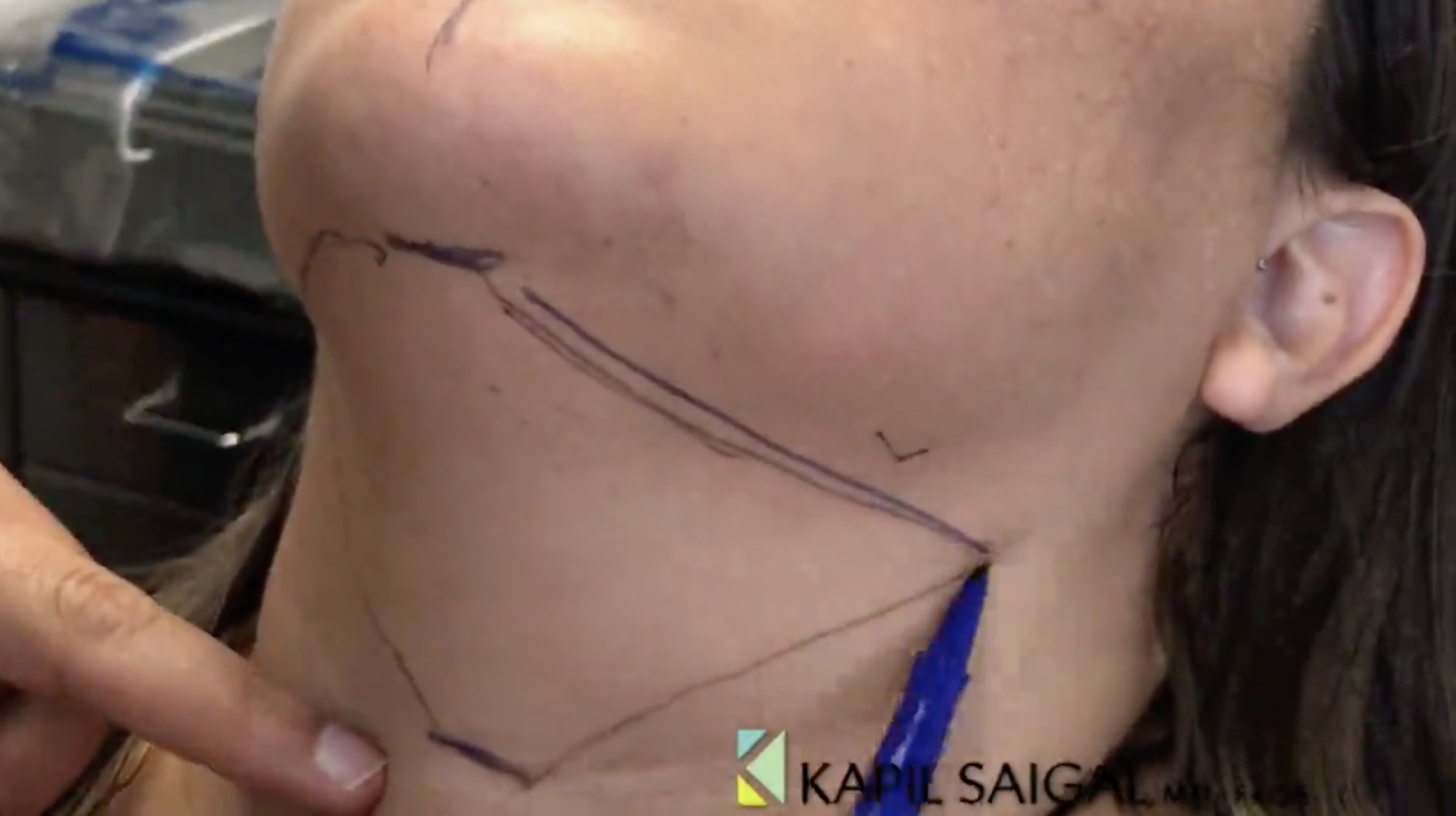 woman's neck 