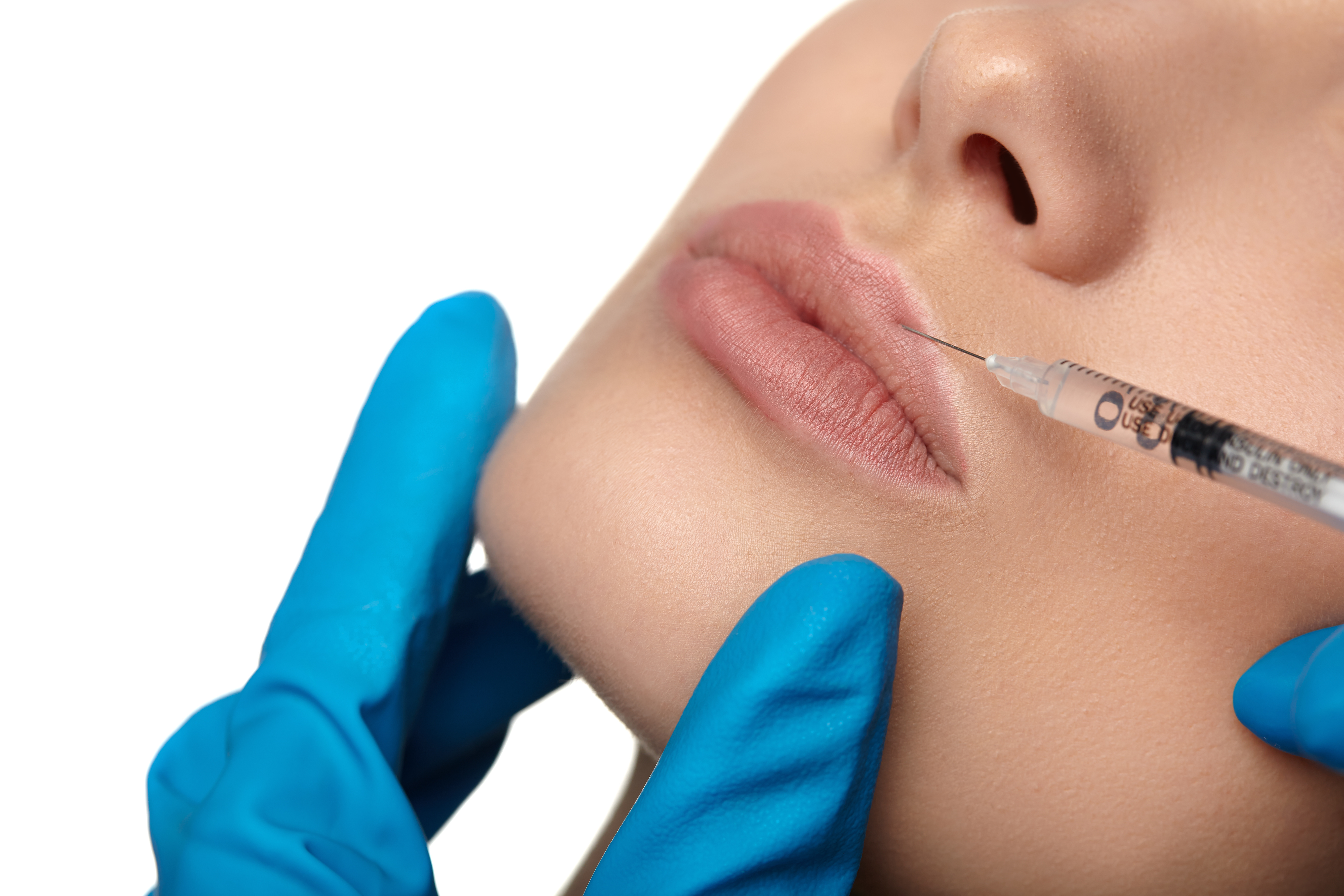 non-invasive lip augmentation