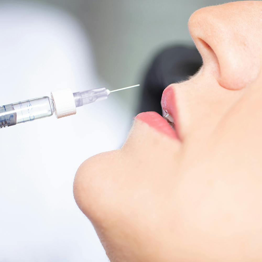 woman getting lip injections