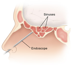 picutre of a nose