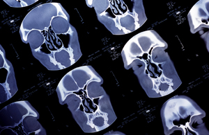 x-ray