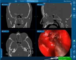 x-ray