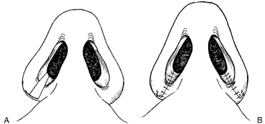 picture of a nose