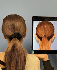 Ear Surgery/Otoplasty Before & After Gallery - Patient 251009 - Image 1