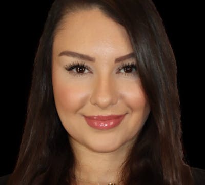 Non-Surgical Rhinoplasty Before & After Gallery - Patient 227155 - Image 2