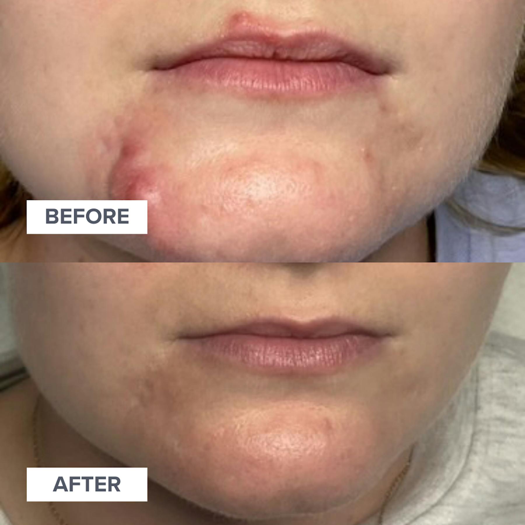 AlumierMD Before and After