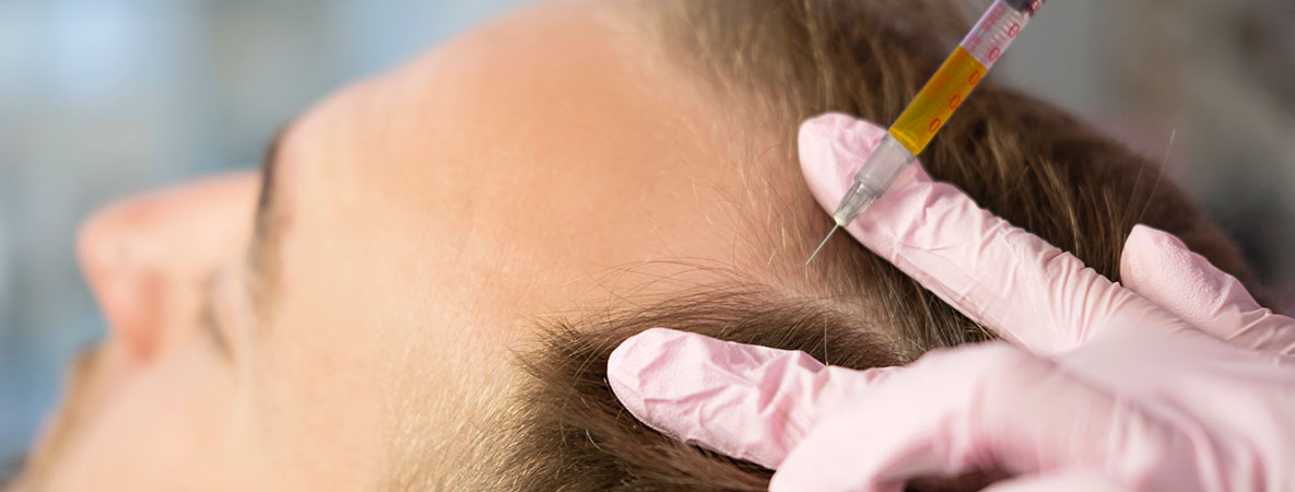 PRP hair restoration consultation at MD Glow Lab in Toronto