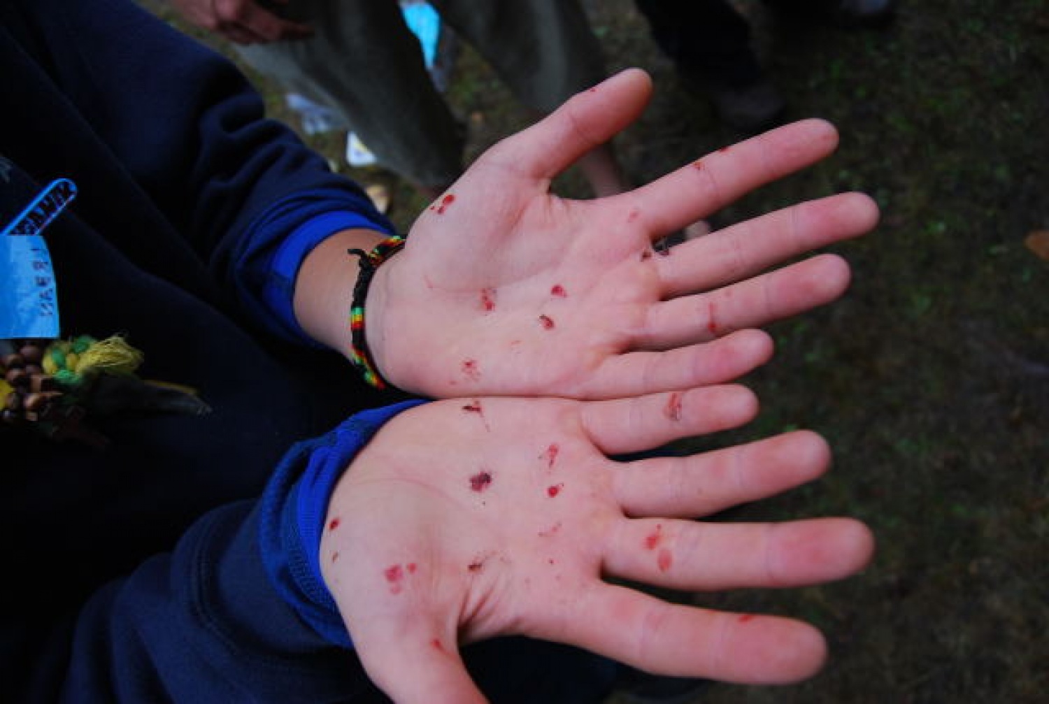 Ne boj, mesarsko klanje komarjev