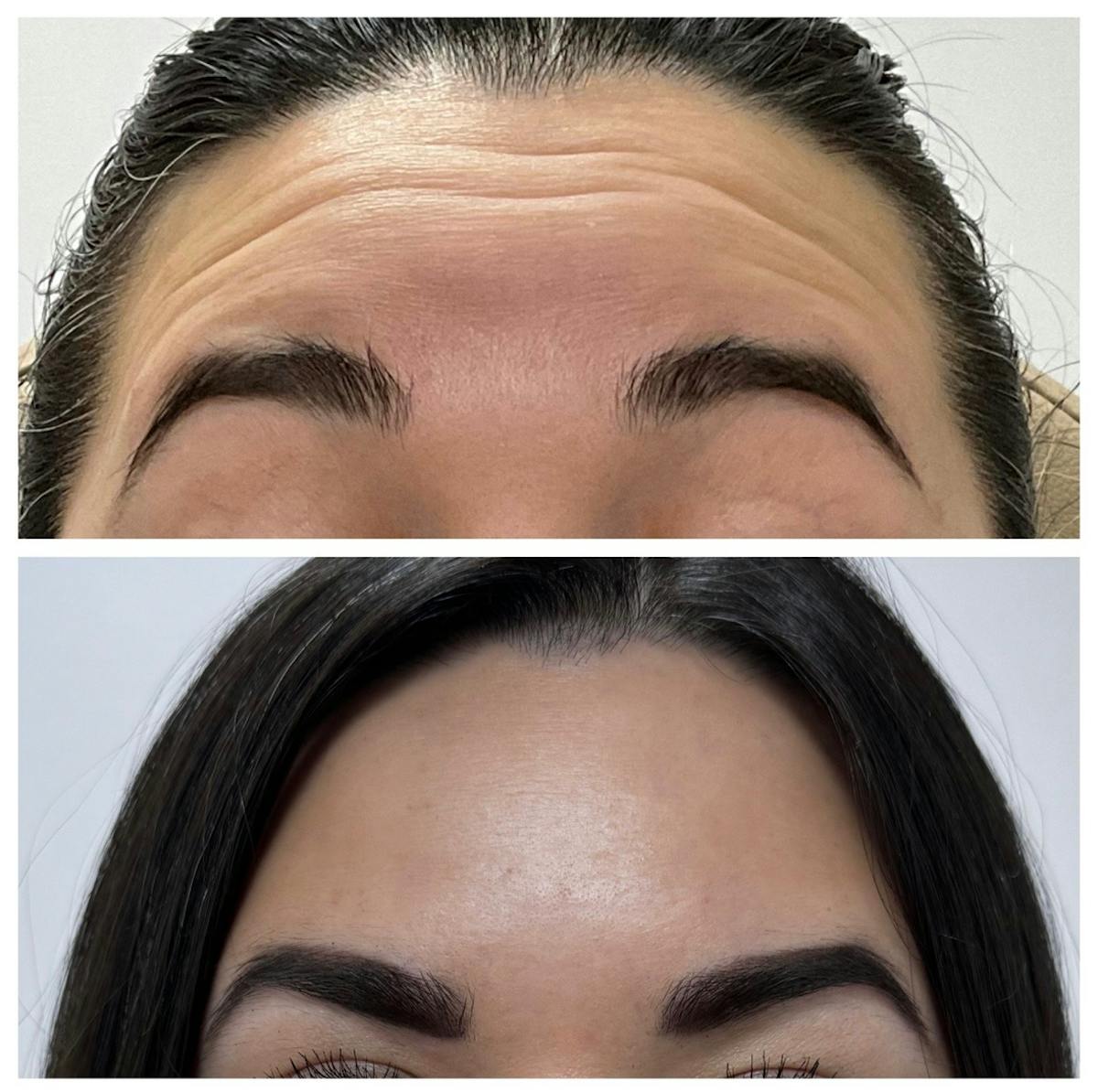 Medspa Services Before & After Gallery - Patient 283399 - Image 1