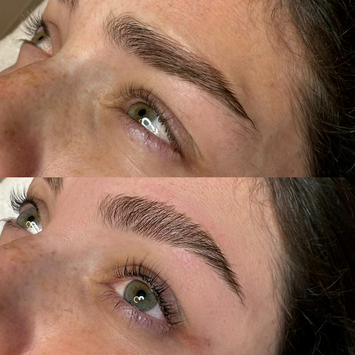 Medspa Services Before & After Gallery - Patient 229862 - Image 1