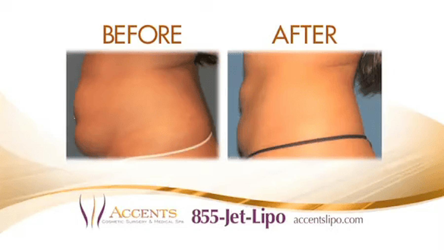 Accents Cosmetic Surgery