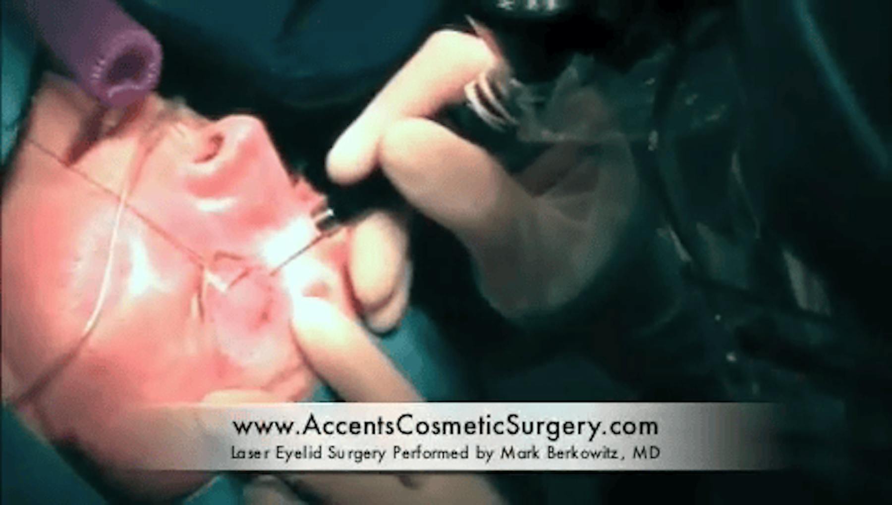 Accents Cosmetic Surgery