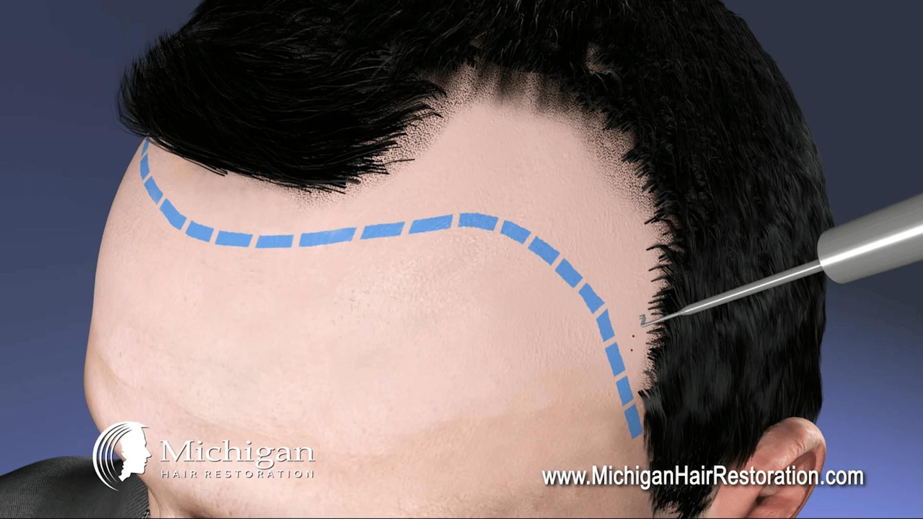 Accents Cosmetic Surgery