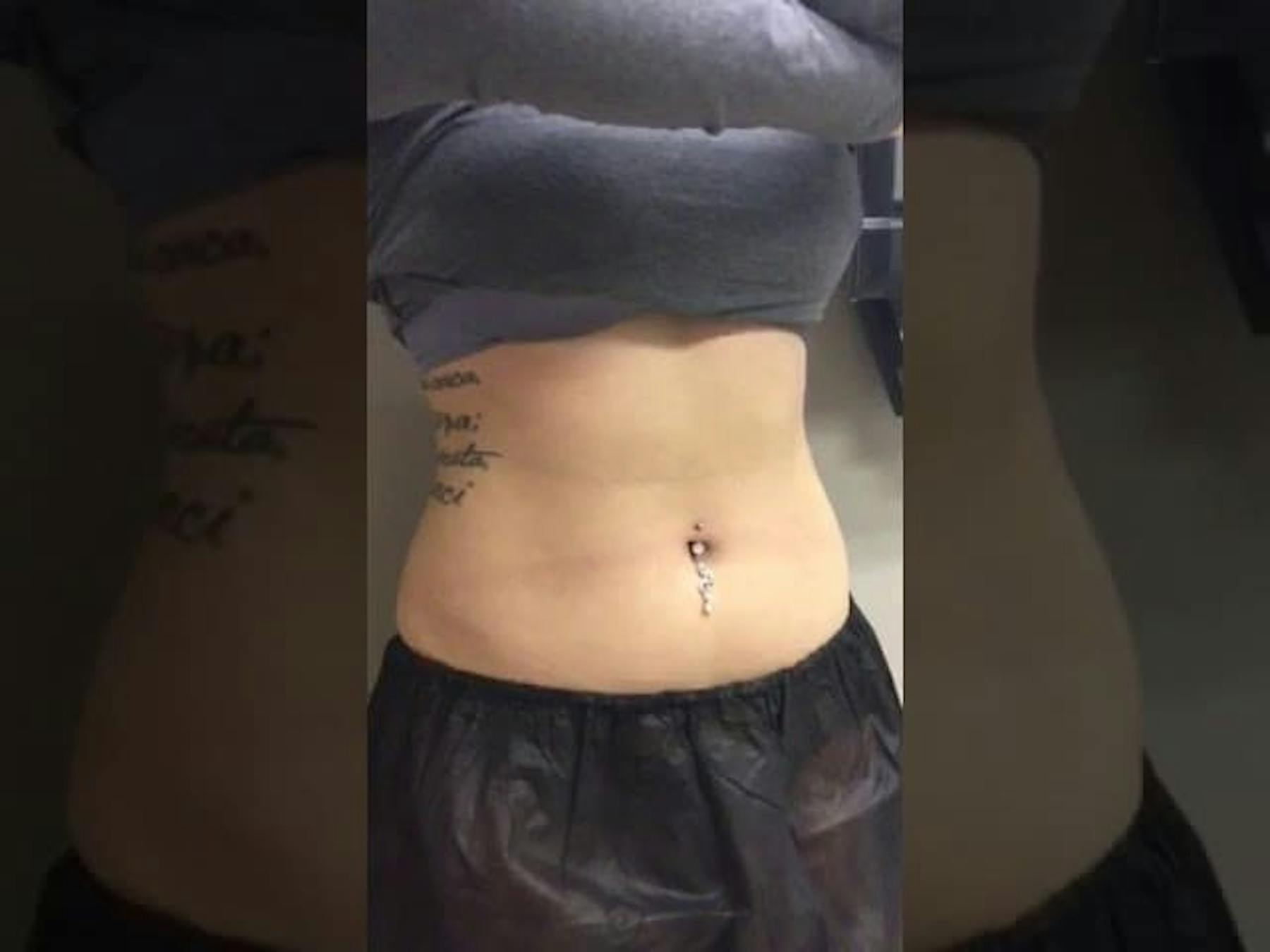 Accents Cosmetic Surgery