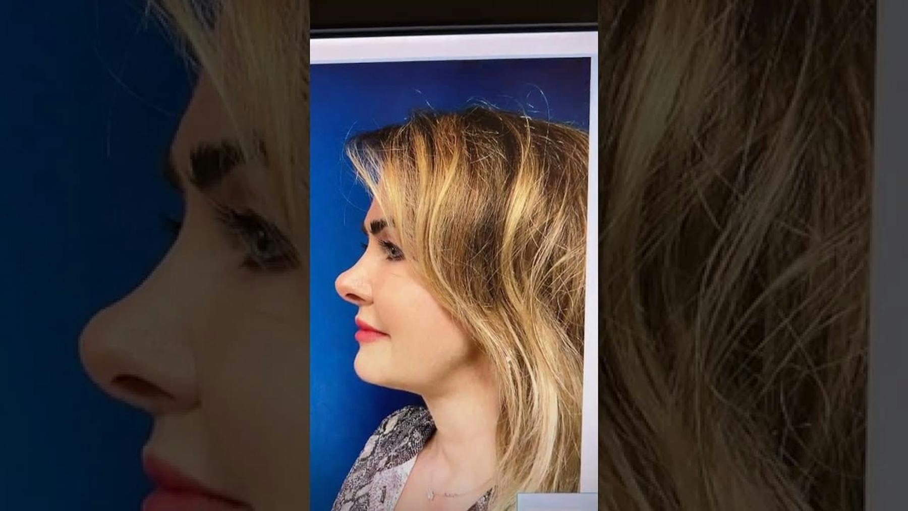 Accents Cosmetic Surgery