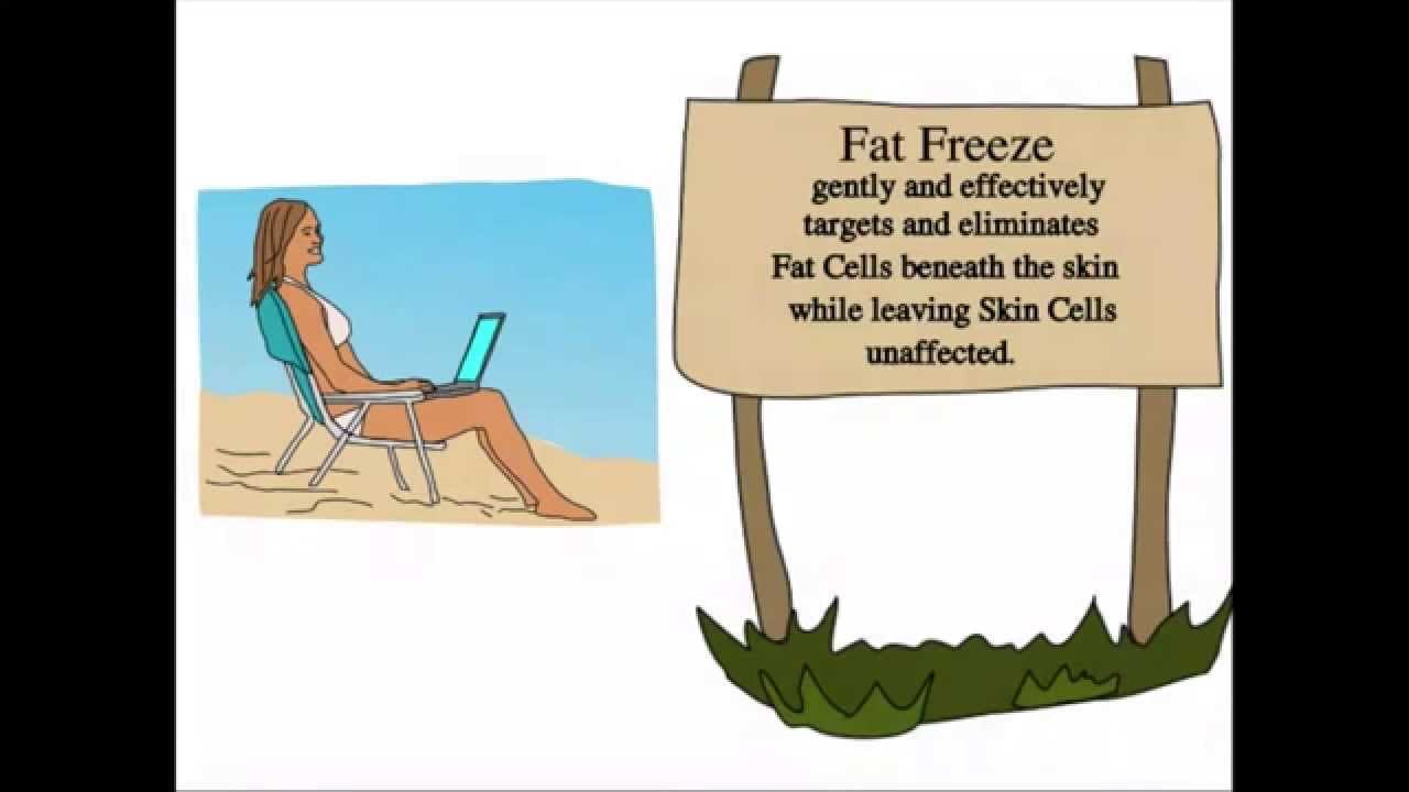 fat freeze coolsculpting