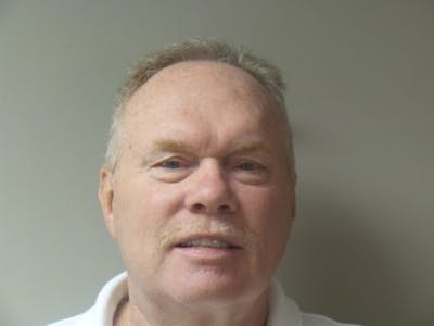 Blepharoplasty Before & After Gallery - Patient 248525 - Image 1