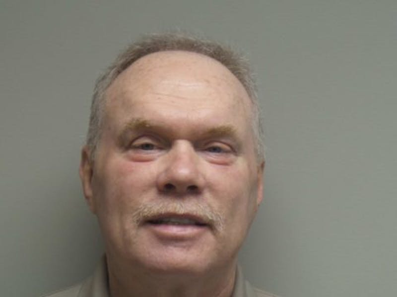 Blepharoplasty Before & After Gallery - Patient 248525 - Image 2