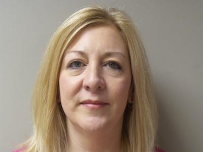 Blepharoplasty Before & After Gallery - Patient 137149 - Image 1