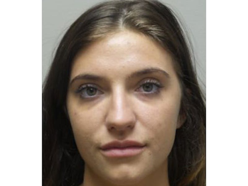 Lip Augmentation Before & After Gallery - Patient 104269 - Image 2