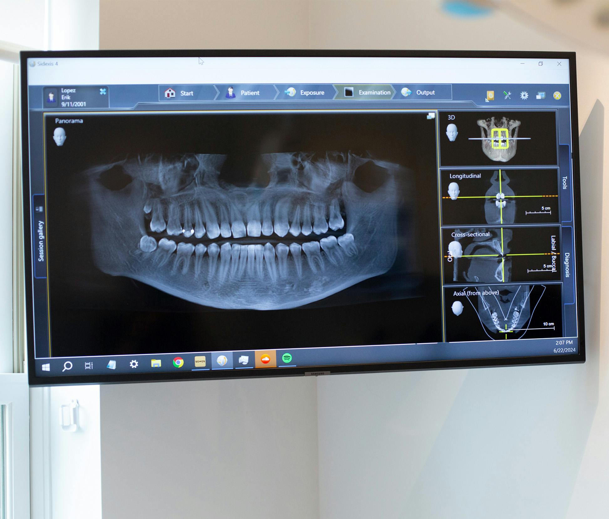 jaw x ray
